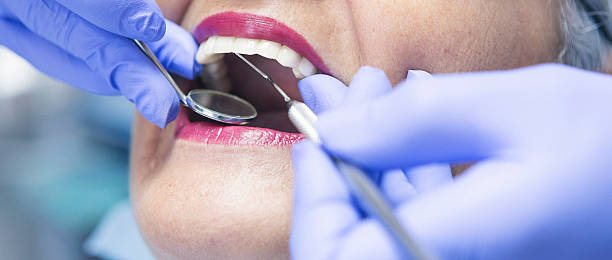 Best Emergency Wisdom Teeth Removal in Elgin, SC